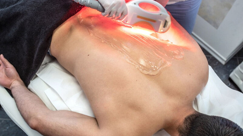 Epilazione Laser - Schiena